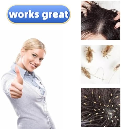 Nit Combs for Lice Double Side Smooth Metal Effective Dandruff/Egg/Head Lice - Image 2