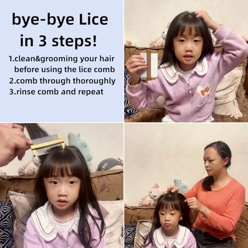 Nit Combs for Lice Double Side Smooth Metal Effective Dandruff/Egg/Head Lice - Image 6